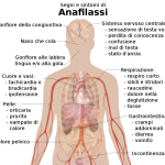 Signs_and_symptoms_of_anaphylaxis-IT